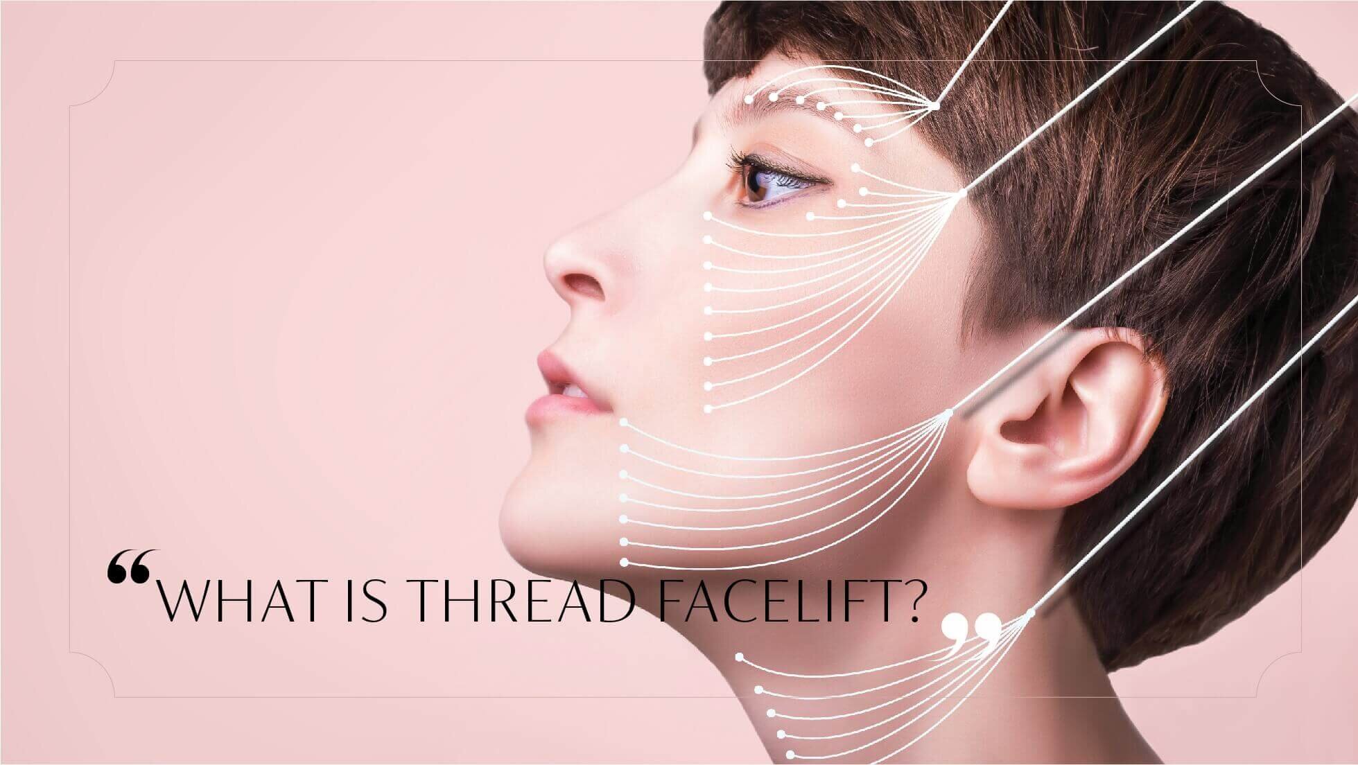 What is a Thread Facelift?